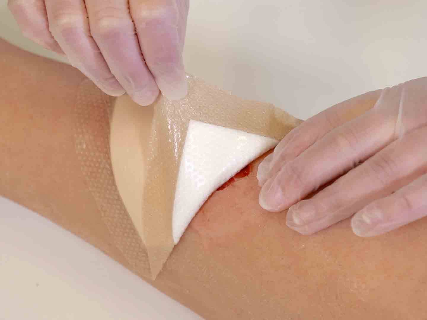 how-to-change-a-wound-dressing-vohra-wound-physicians